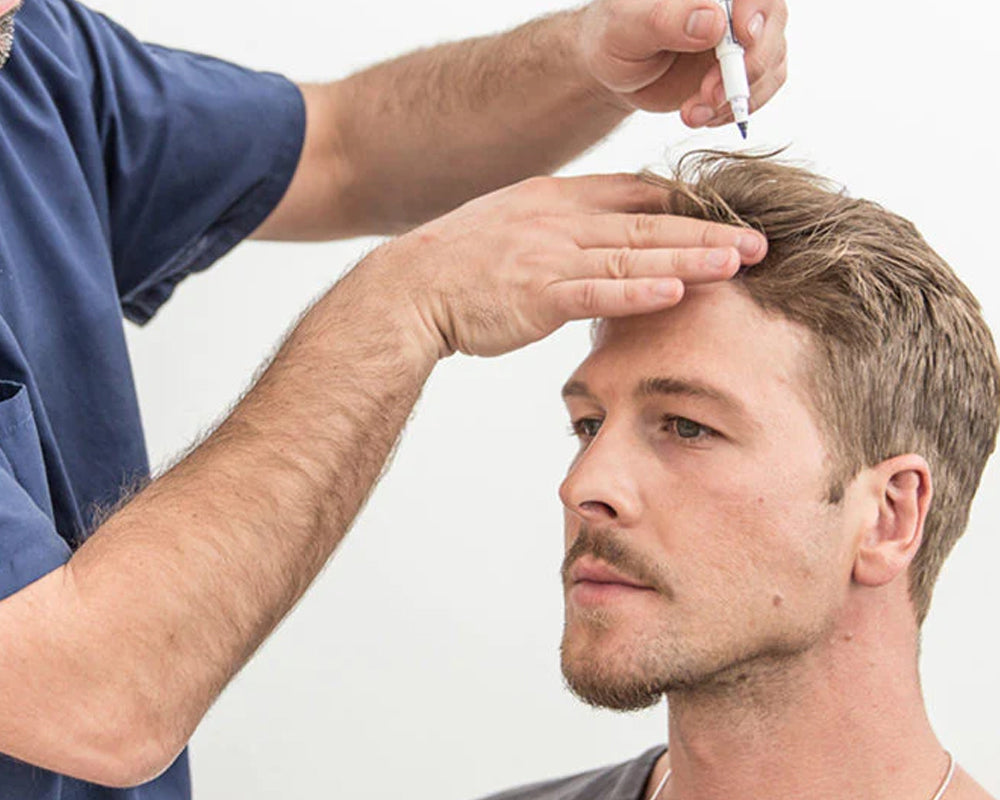 How to Choose the Right Male Hair Transplant in Dubai